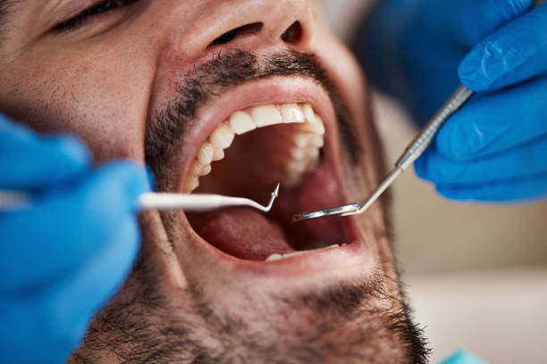 Best Broken or Chipped Tooth Repair in Nashville, MI